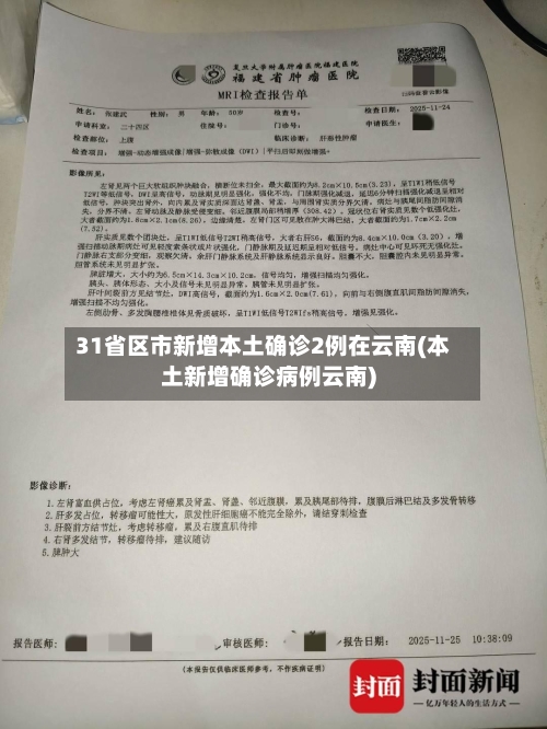 31省区市新增本土确诊2例在云南(本土新增确诊病例云南)