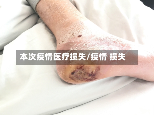 本次疫情医疗损失/疫情 损失