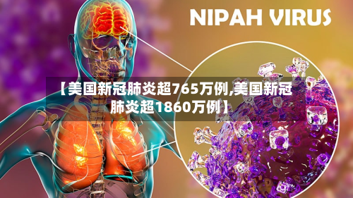 【美国新冠肺炎超765万例,美国新冠肺炎超1860万例】