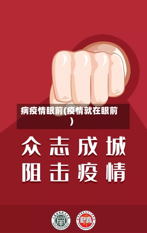 病疫情眼前(疫情就在眼前)-第3张图片