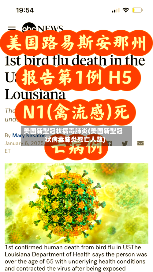 美国新型冠状病毒肺炎(美国新型冠状病毒肺炎死亡人数)-第2张图片