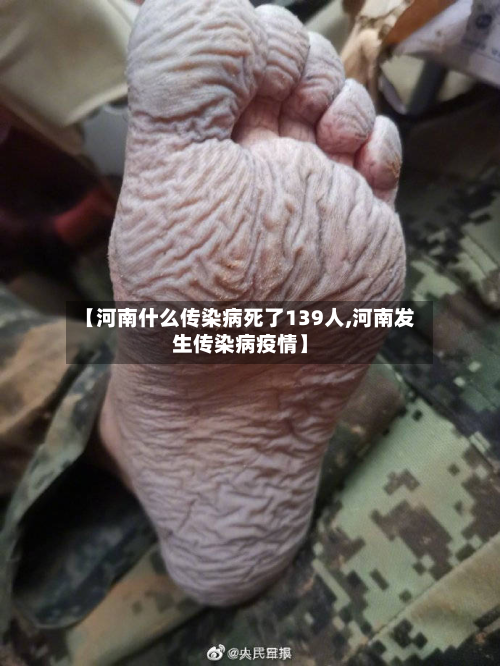 【河南什么传染病死了139人,河南发生传染病疫情】-第2张图片