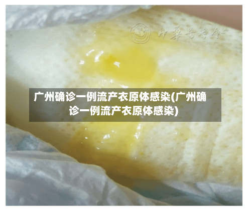 广州确诊一例流产衣原体感染(广州确诊一例流产衣原体感染)