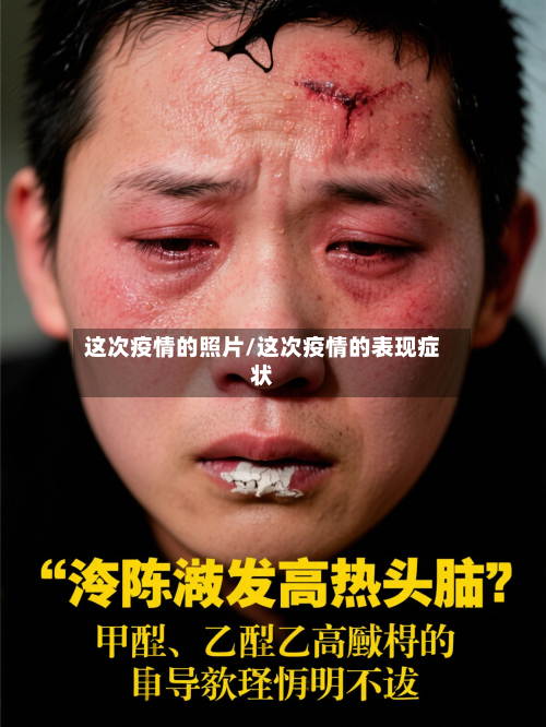 这次疫情的照片/这次疫情的表现症状-第3张图片