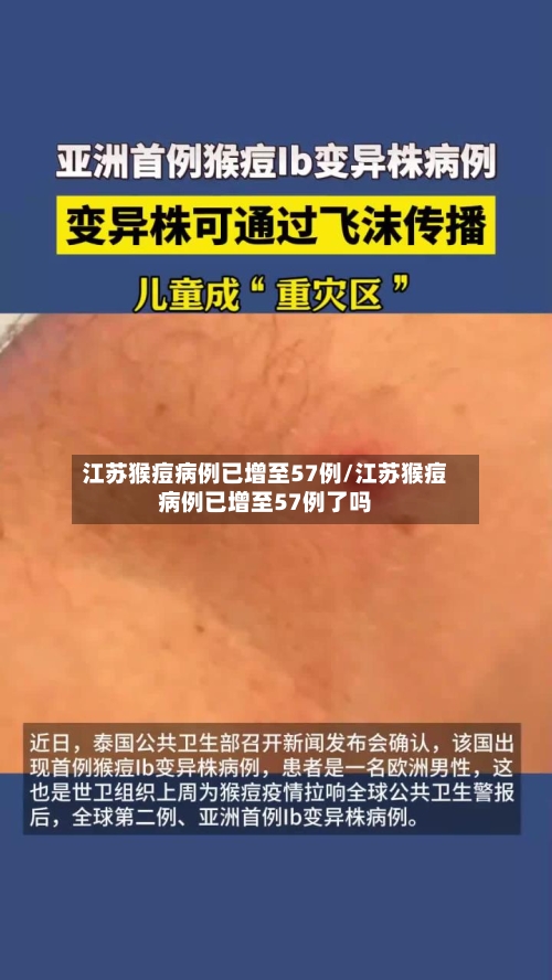 江苏猴痘病例已增至57例/江苏猴痘病例已增至57例了吗