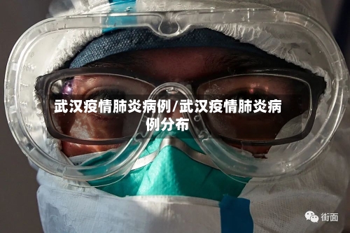 武汉疫情肺炎病例/武汉疫情肺炎病例分布-第3张图片