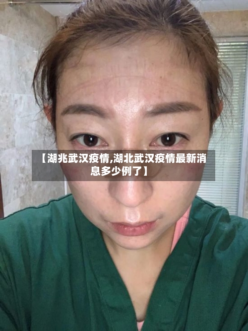 【湖兆武汉疫情,湖北武汉疫情最新消息多少例了】-第2张图片