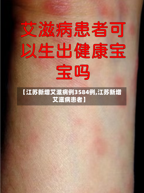 【江苏新增艾滋病例3584例,江苏新增艾滋病患者】