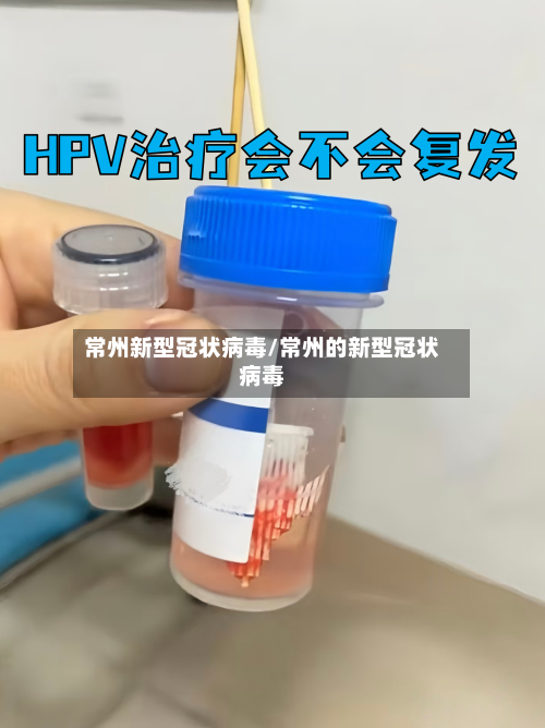 常州新型冠状病毒/常州的新型冠状病毒