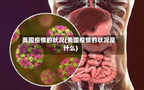 美国疫情的状况(美国疫情的状况是什么)-第2张图片