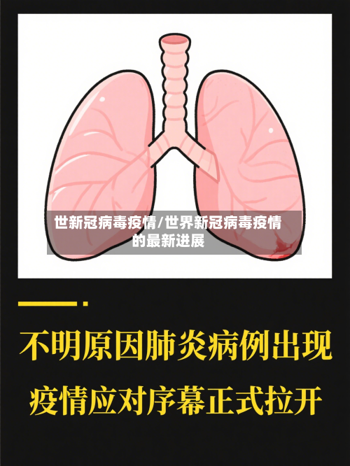 世新冠病毒疫情/世界新冠病毒疫情的最新进展-第3张图片