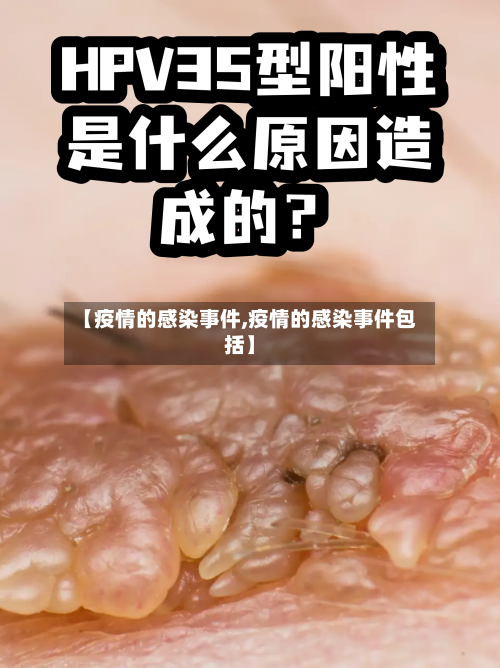 【疫情的感染事件,疫情的感染事件包括】