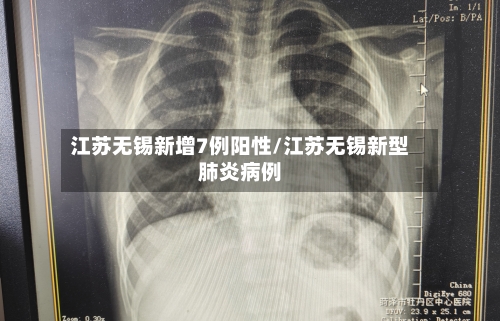 江苏无锡新增7例阳性/江苏无锡新型肺炎病例
